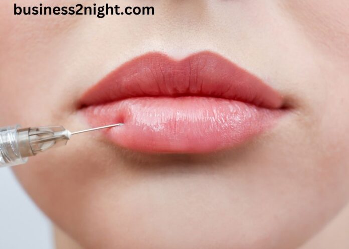 Lip Filler Swelling Stages: Understanding the Process